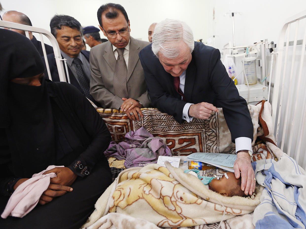 UN humanitarian aid chief Stephen O'Brien, a British diplomat, looking at a child during a visit to the Mother and Child hospital in the Yemeni capital Sanaa: Getty