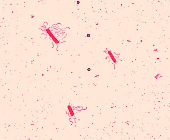 A Bacillus species with evident flagella, the whiplike tails many microbes use to move around.