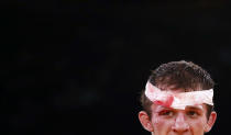 Russia's Alan Khugaev looks on bleeding during his combat at the Men's 84Kg Greco-Roman wrestling at the ExCel venue during the London 2012 Olympic Games August 6, 2012. REUTERS/Adrees Latif (BRITAIN - Tags: OLYMPICS SPORT WRESTLING TPX IMAGES OF THE DAY) 