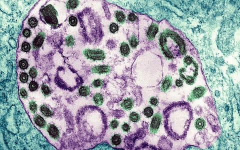 Electron Micrograph Of The Marburg Virus - Credit: BSIP/UIG Via Getty Images