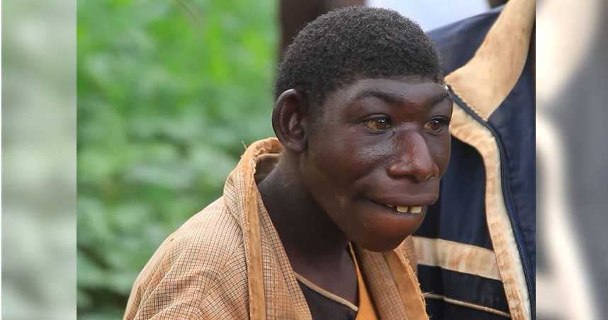 21歲少年罹「小頭畸形」屢遭霸凌，為躲避村民日走32公里進叢林。（圖／翻攝自Afrimax TV YouTube）