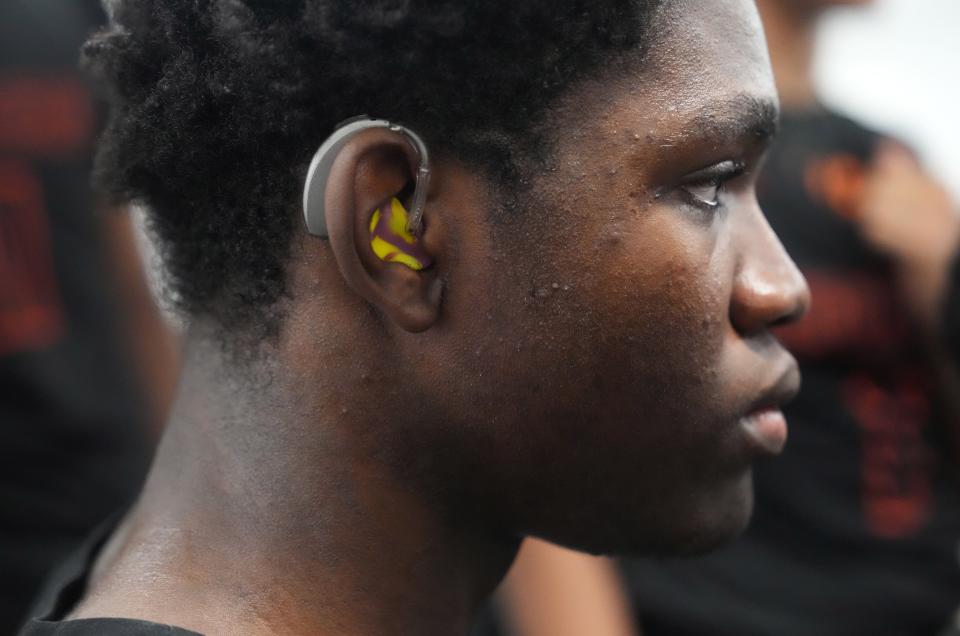 John I. Leonard basketball player Lovinske Louis uses hearing aids.