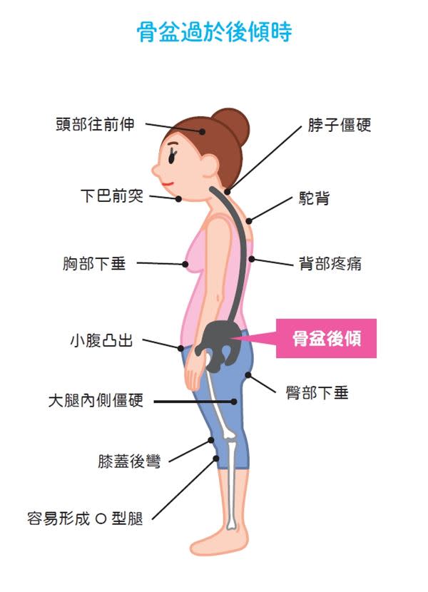 你的身體「歪斜」了嗎？小心6種NG走路姿勢害健康，專家教你檢視走對了沒