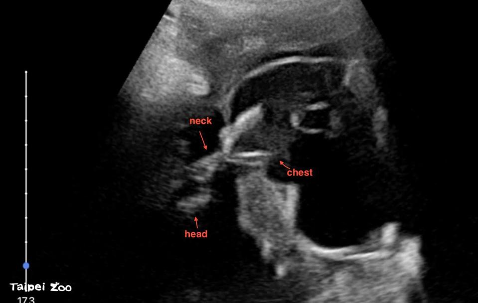 「貘莉」2023年初次超音波掃描就確認了胎兒影像，小傢伙預計在今年6月報到！。（台北市立動物園提供）
