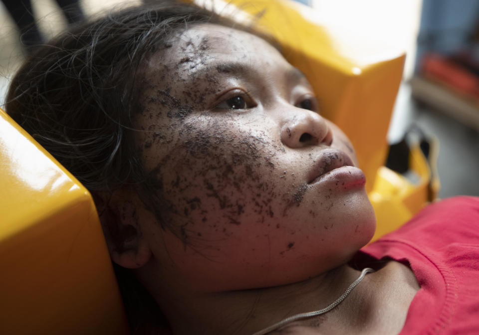 An injured ethnic Karen villager from Myanmar rests as she is treated after crossing the Salawin river via boat at Ban Mae Sam Laep Health Center, Mae Hong Son province, Thailand on Tuesday March 30, 2021. The weekend strikes by the Myanmar military, which sent ethnic people to seek safety in Thailand, represented another escalation in the violent crackdown by Myanmar’s junta on protests of its Feb. 1 takeover. (AP Photo/Sakchai Lalit)