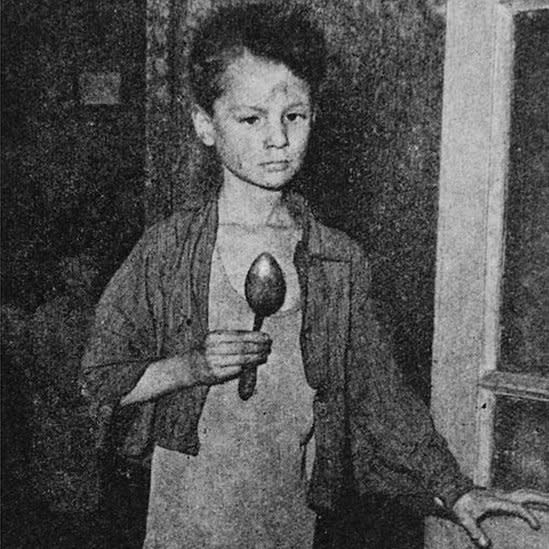 Niño hambriento en los Países Bajos, 1944