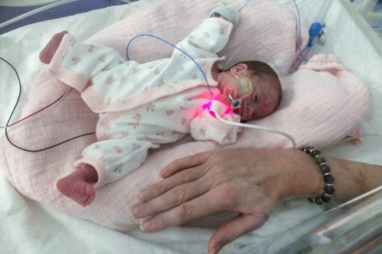 Edie Madoc-Jones was born at just 23 weeks 4 weighing 1 lb 4 oz [Photo: Caters]