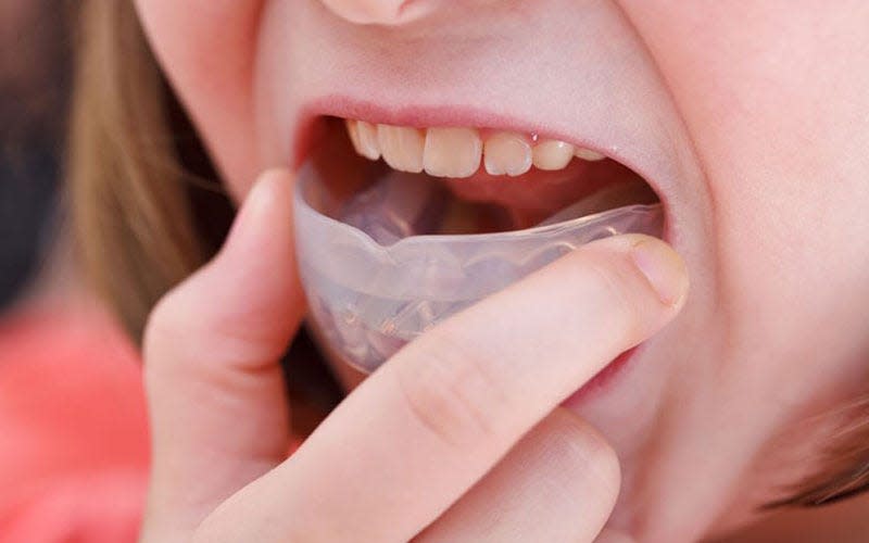 To make mouthguards more accessible for kids, Delta Dental is giving away free boil and bite mouthguards to coaches and youth sports league officials.