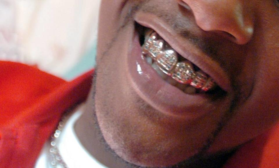 This Associated Press file photo shows tooth jewelry known as a “grill” made of white gold and blue diamonds worn by the hip-hop artist Rudy in Fort Wayne, Indiana. Two brothers in East St. Louis were sentenced this week for kidnapping a man they had accused of stealing a similar mouthpiece. Cathie Rowand/Fort Wayne Journal Gazette