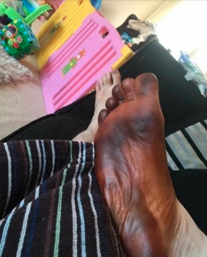 He thought something was seriously wrong with his foot, and we don't blame him! Photo: Facebook