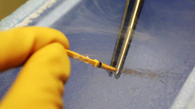 Close-up of a gloved hand freezing female eggs with liquid nitrogen.