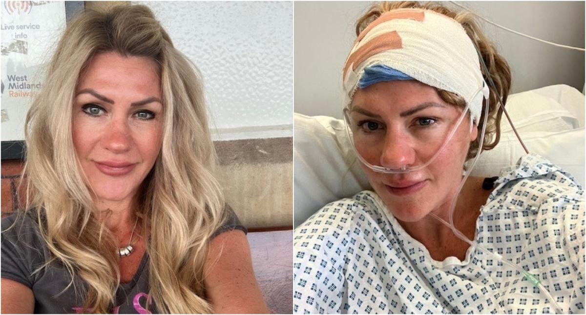 Woman, 43, reveals first symptom of her ‘golf ball-sized’ brain tumour