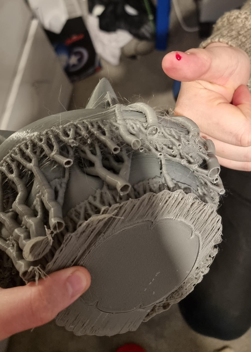 3D printing opinion piece