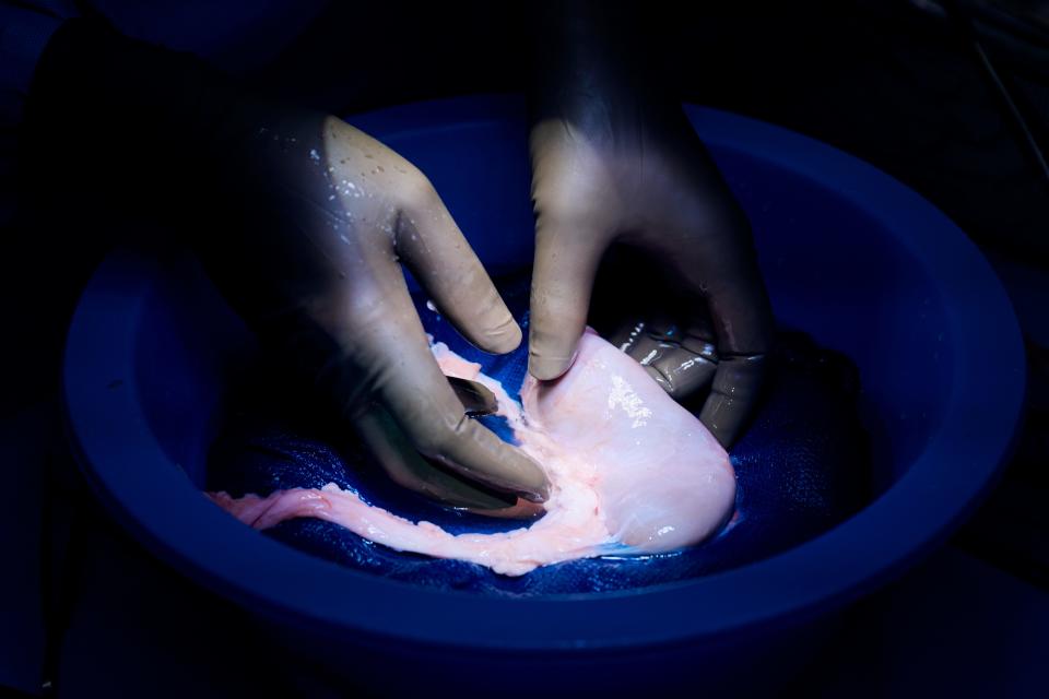 The gene edited pig kidney and thymus is prepared for transplantation on April 12.