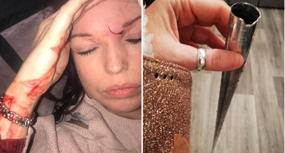 Mum Clarissa Clary suffered an injury just centimetres from her eye when a toy she had bought for her son popped open