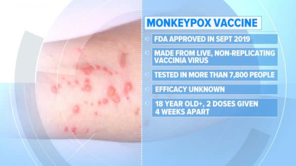 PHOTO: What to know about monkeypox as the virus continues to spread in the United States. (ABC News)