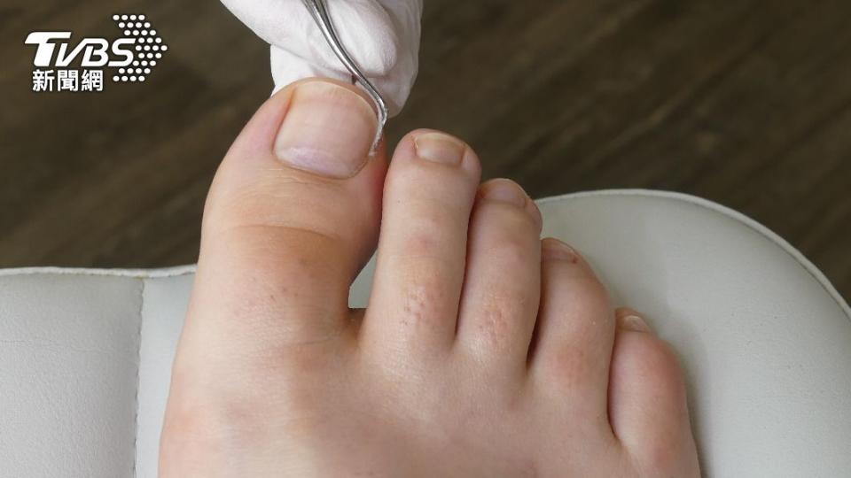腳指甲能反應身體健康狀況。（示意圖／shutterestock達志影像）