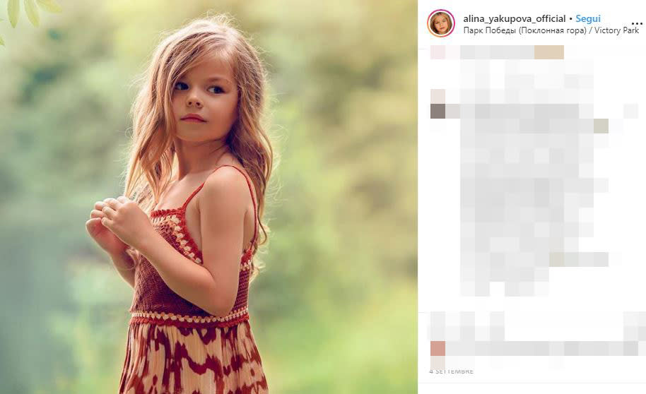 Yakupova è rappresentata dall'agenzia di moda per bambini, President Kids (PK) Management, la stessa che seguiva un'altra giovane modella russa, Anastasia Knyazeva. Quest'ultima si era guadagnata nel 2016, all'età di 6anni, lo scettro di "bambiba più bella del mondo". Prima di loro il titolo era nelle mani della modella francese Thylane Blondeau, figlia del calciatore Patrick Blondeau, che oggi ha 18 anni.