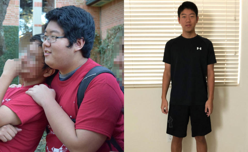 Even though Jacky Hao is happy with his weight loss, he still struggles with body-image issues. (Photo: Courtesy of Jacky Hao)