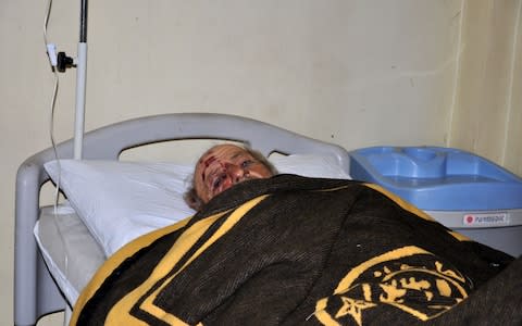 A Syrian pro-regime fighter who was also wounded in the US airstrikes on February 7 is seen in a hospital - Credit: AFP/Getty Images