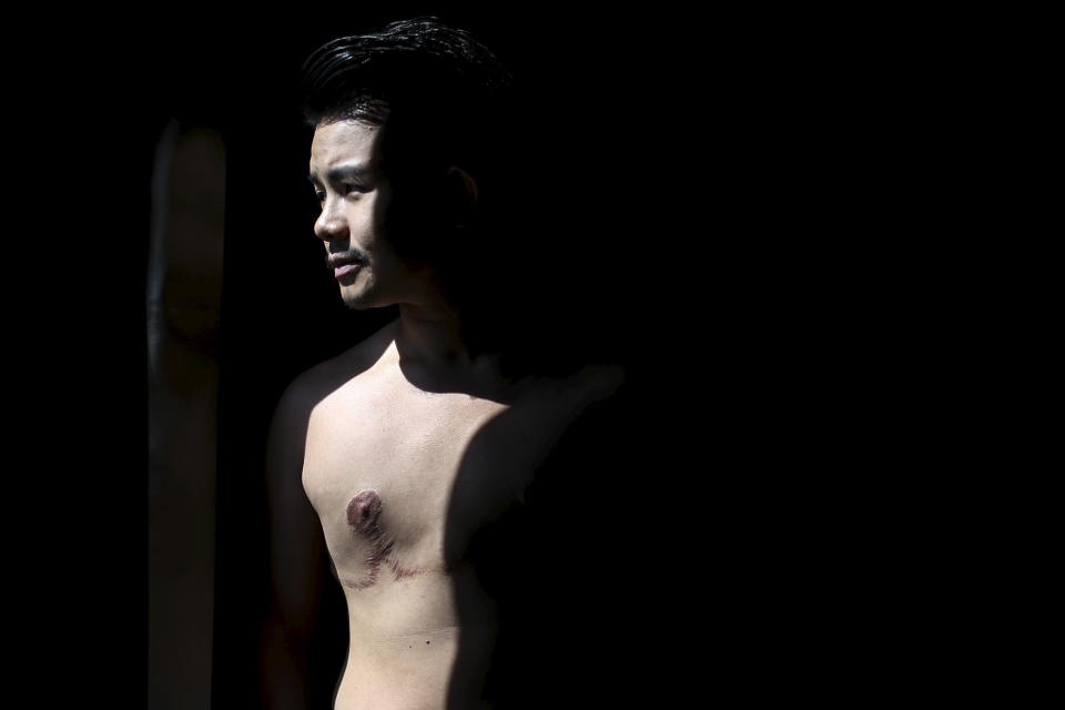 Joe Wong, 31, poses for a photograph at his apartment in Bangkok, Thailand, on April 3, 2015. The 31-year-old transgender man from Singapore underwent surgery to remove his breasts in 2007 and legally changed his name from Joleen to Joe. He had his uterus removed in 2009 and is legally recognized as a male. Wong is one of the many lesbian, gay, bisexual and transgender people in Asia who faced abuse and violence from his family. To escape the violence and find acceptance, many LGBTQ people migrate abroad -- including Wong, who moved to Bangkok, where he works for the rights group Asia Pacific Transgender Network.