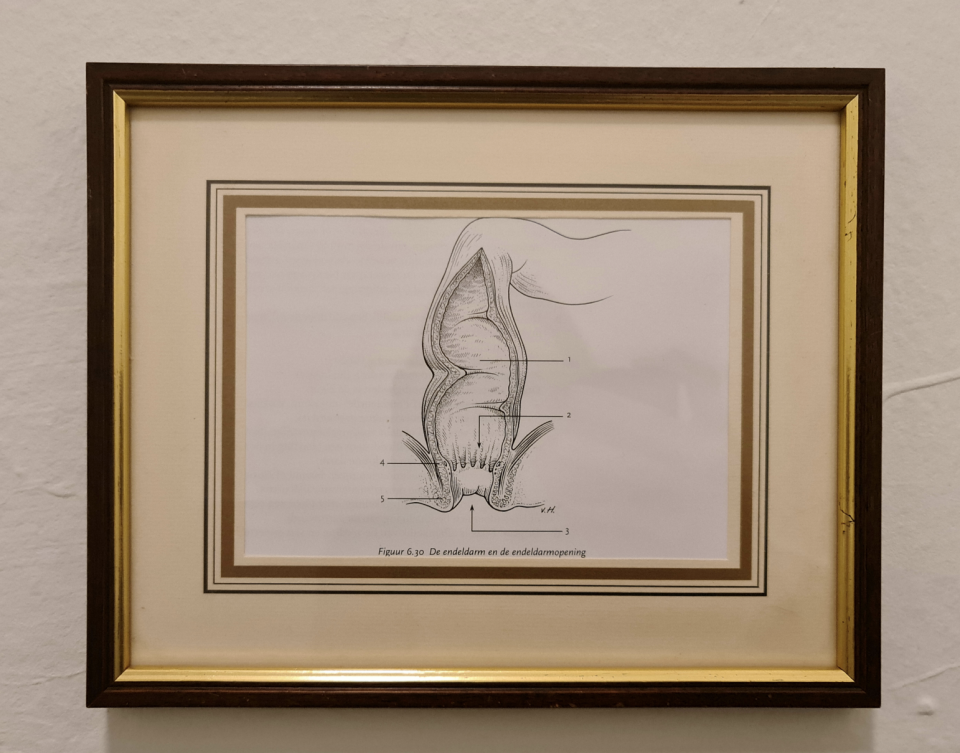 A framed picture on the bathroom wall is a diagram of feces passing through the intestine