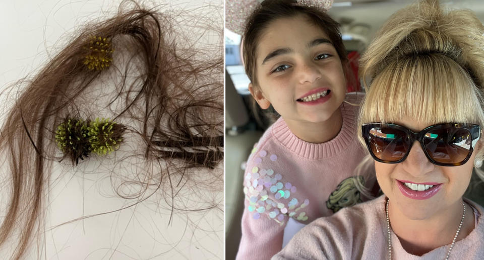 Mum of six-year-old girl forced to cut out hair after Bunchems got stuck 