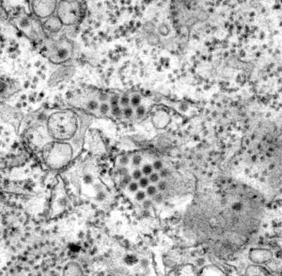 Les particules du virus de la dengue, rondes et sombres, sont bien visibles sur cette image prise au microscope électronique à transmission. <a href="https://phil.cdc.gov/Details.aspx?pid=12493" rel="nofollow noopener" target="_blank" data-ylk="slk:Frederick Murphy/CDC;elm:context_link;itc:0;sec:content-canvas" class="link ">Frederick Murphy/CDC</a>