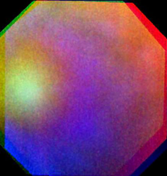 A false-color composite image of a "glory" seen on Venus July 24, 2011. The picture combines ultraviolet, visible and near-infrared wavelength images from the Venus Monitoring Camera aboard ESA's Venus Express. The glory was about 1,200 kilomet