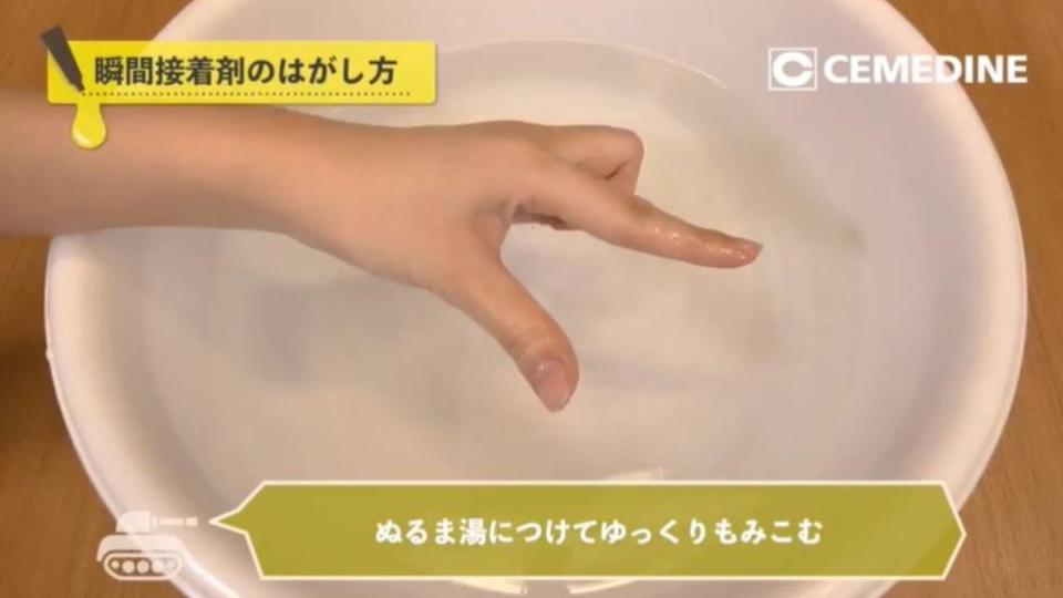 手不慎被三秒膠黏住，可泡入40度的溫熱水中搓揉。（圖／翻攝自X）