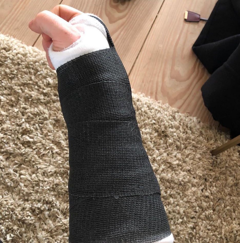 <p>Poor Ed Sheeran — and his fans! “A visit to my doctors confirmed fractures in my right wrist and left elbow that will leave me unable to perform live concerts for the immediate future,” a post to his followers read, after the singer announced earlier he had “a bit of a bicycle accident.” He continued, “Sadly, this means that the following shows will not be able to go ahead as planned: Taipei, Osaka, Seoul, Tokyo and Hong Kong. I’m waiting to see how the healing progresses before we have to decide on shows beyond that. Please stay tuned for more details.” (Photo: <a rel="nofollow noopener" href="https://www.instagram.com/p/BaXdjITFRlA/?taken-by=teddysphotos" target="_blank" data-ylk="slk:Ed Sheeran via Instagram" class="link rapid-noclick-resp">Ed Sheeran via Instagram</a>) </p>