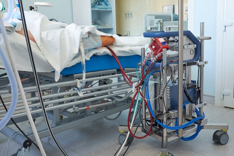 <span class="caption">ECMO is expensive and highly complex.</span> <span class="attribution"><a class="link " href="https://www.shutterstock.com/image-photo/extracorporeal-membrane-oxygenation-working-ecmo-machine-1630570855" rel="nofollow noopener" target="_blank" data-ylk="slk:Kiryl Lis/Shutterstock;elm:context_link;itc:0;sec:content-canvas">Kiryl Lis/Shutterstock</a></span>