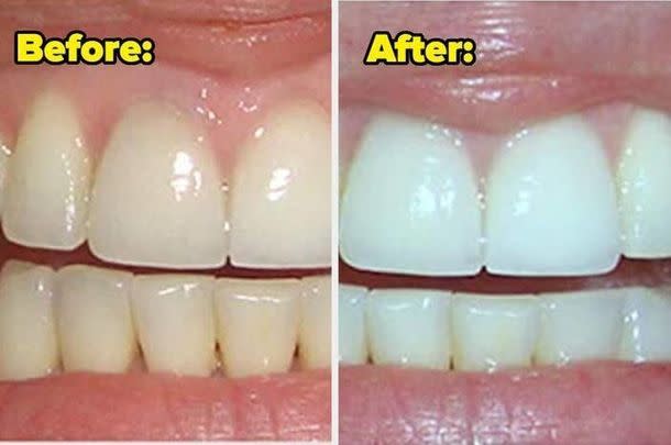 Reviewers reckon this whitening tooth powder delivers speedy results.