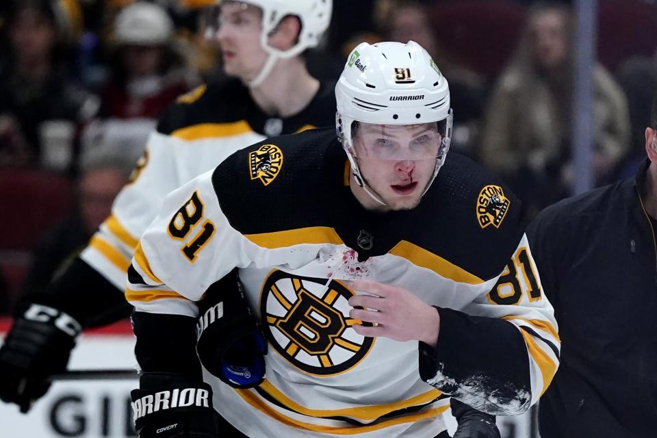 Boston Bruins left wing Anton Blidh (81) skates off the ice after taking a stick to the face from a teammate during the second period of an NHL hockey game against the Arizona Coyotes, Friday, Jan. 28, 2022, in Glendale, Ariz. (AP Photo/Ross D. Franklin)