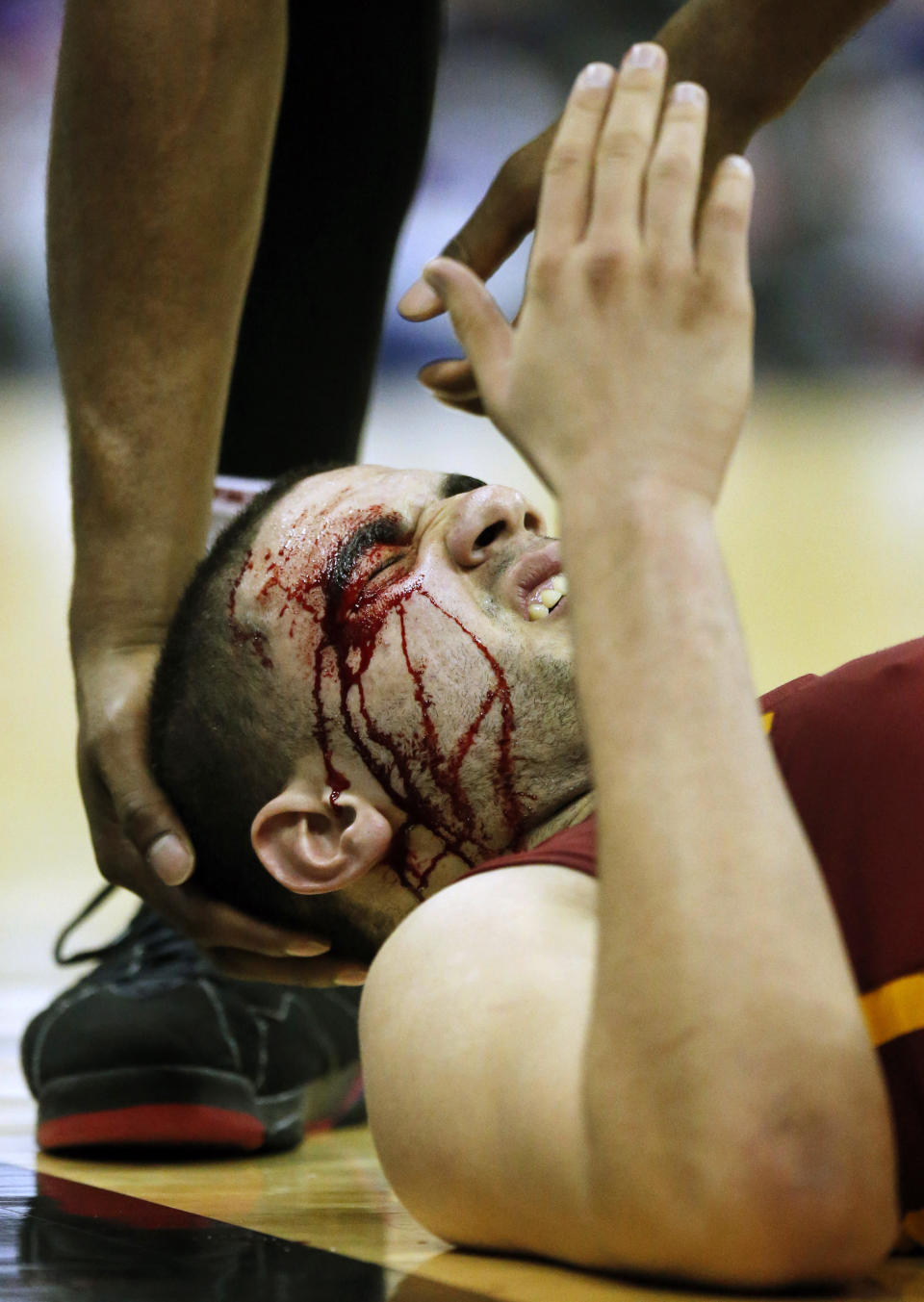 A teammate holds the head of Iowa State forward Georges Niang (31) after an injury from taking a charge by Kansas guard Brannen Greene during the second half of an NCAA college basketball game in the semifinals of the Big 12 Conference men's tournament in Kansas City, Mo., Friday, March 14, 2014. Iowa State defeated Kansas 94-83. (AP Photo/Orlin Wagner)