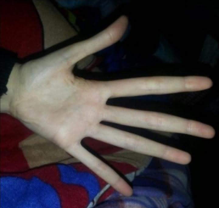 A hand with extremely long fingers