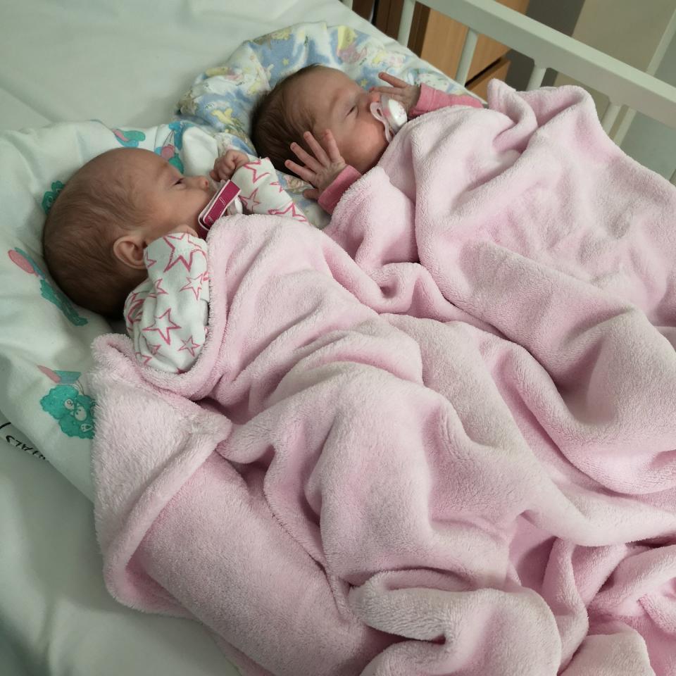 Surprise twins Phoebe and Aria shortly after they were born. (SWNS)