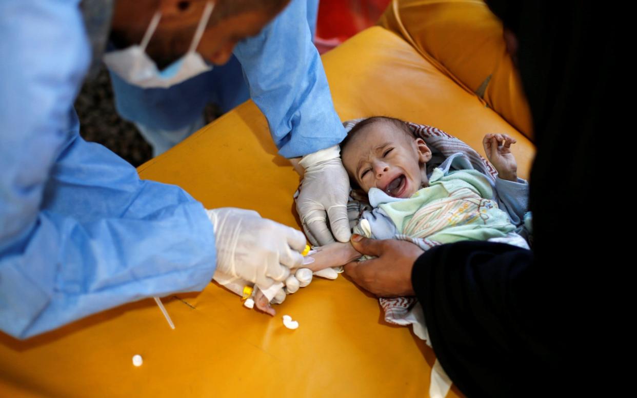 A boy cries as he is being treated at a cholera treatment centre at the al-Sabeen hospital in Sanaa - REUTERS