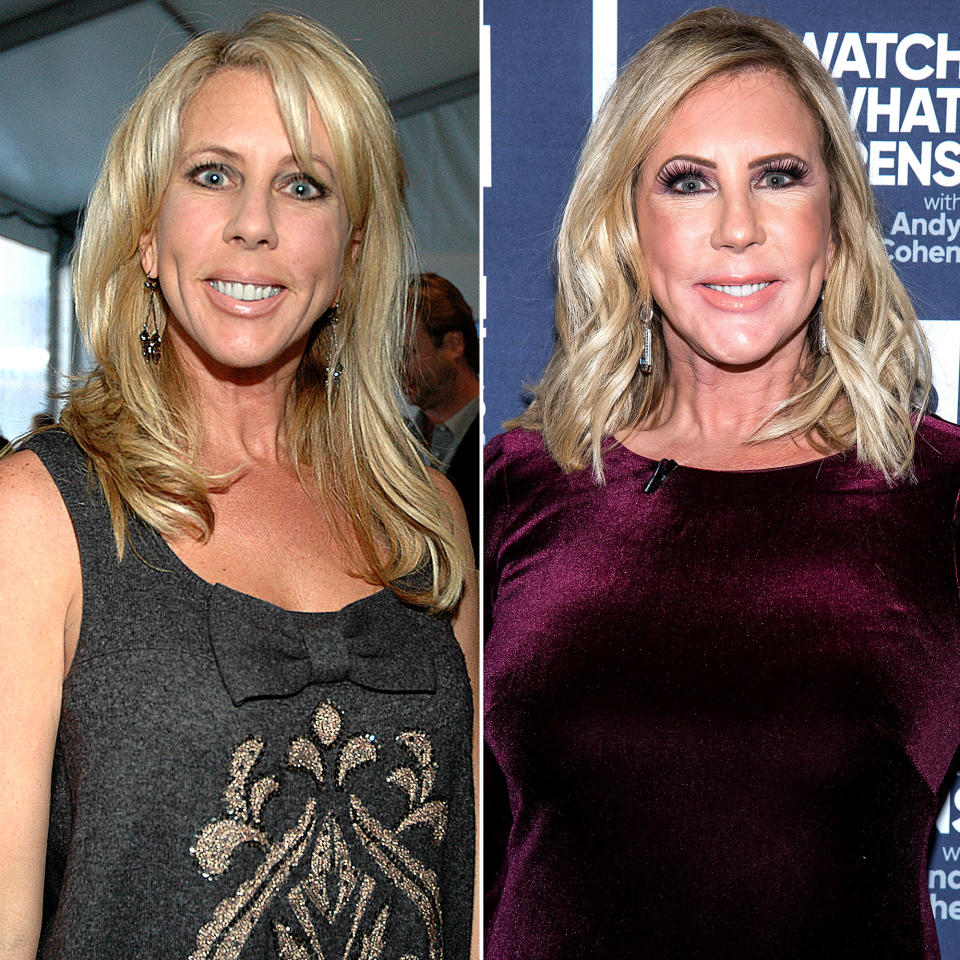 Vicki Gunvalson