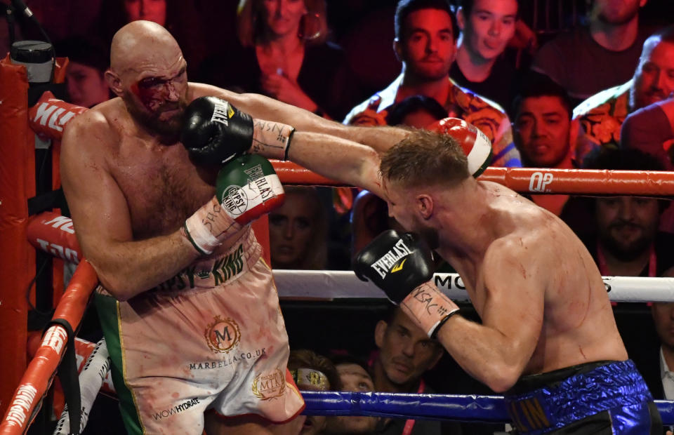 Fury entró con un short tricolor que acabó manchado de sangre. (Gene Blevins/Getty Images)