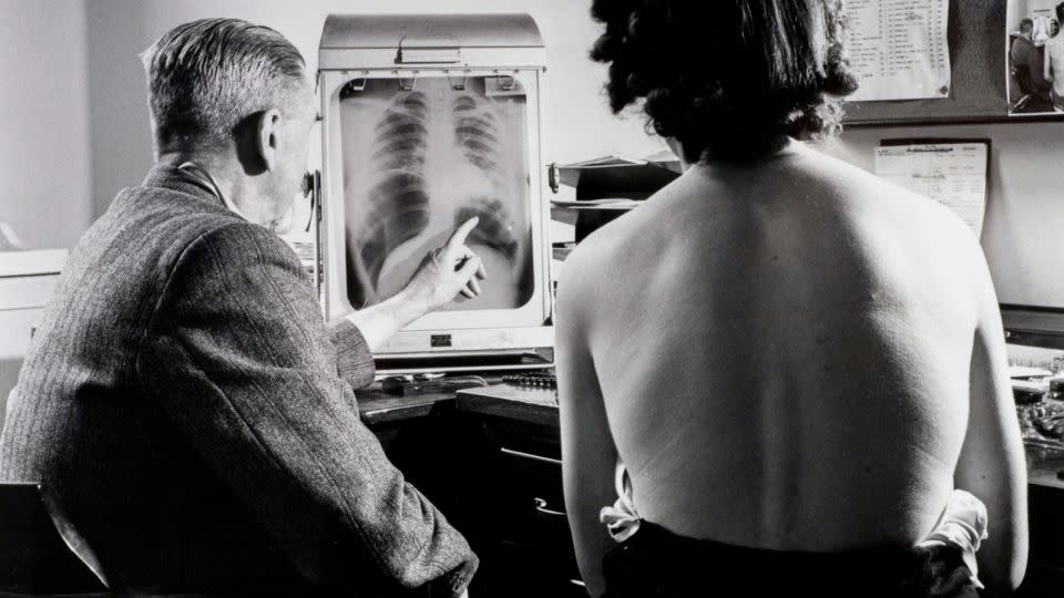 A patient with a chest specialist at a Bristol health center inspect a chest X-ray in July 1948, the month the NHS launched. - Popperfoto/Getty Images