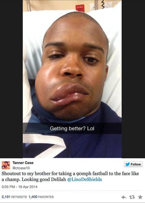 Houston Astros minor-leaguer Delino DeShields Jr. hit in the face by 90 mph  fastball