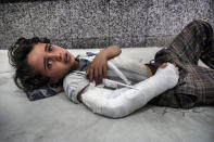 <p>Al Joumhouri Hospital, Sana’a, Yemen, May 3, 2017: A young boy lies in the emergency room awaiting treatment. (Photograph by Giles Clarke for UN OCHA/Getty Images) </p>