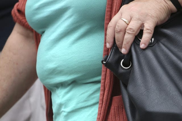 Obesity increases dementia risk