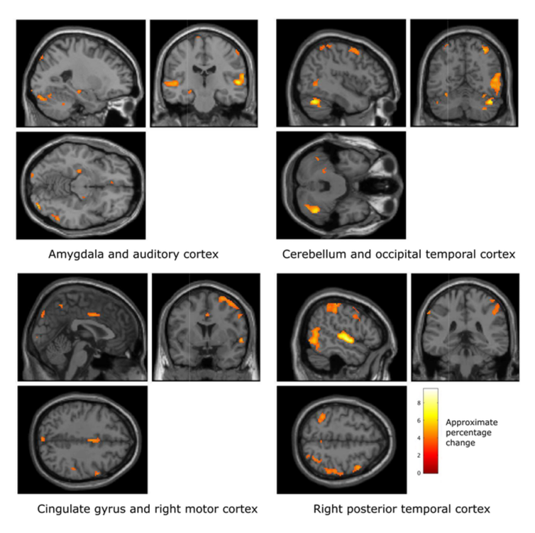 <span class="caption">fMRI data from study.</span> <span class="attribution"><span class="license">Author provided</span></span>