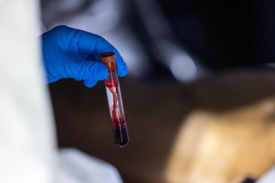 A blood sample is taken from one of the carcasses of a whitetail deer during a deer depopulation at RW Trophy Ranch in Terrell on Tuesday, May 28, 2024.