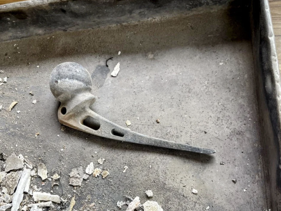 a titanium hip