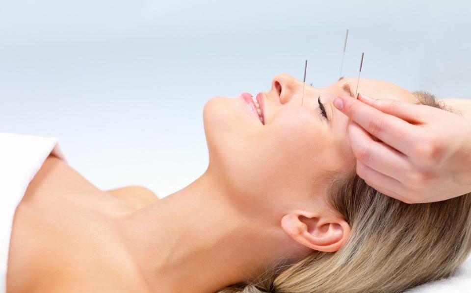 A couple of small studies have shown acupuncture can help with hay fever symptoms
