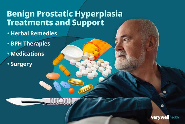 Benign Prostatic Hyperplasia BPH Guide To Treatment