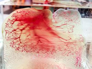 Human vasculature model created using Print to Perfusion process (Image courtesy of United Therapeutics)